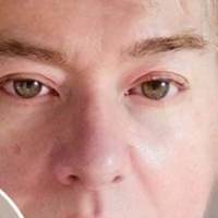   Mujer de 62 años Merlo