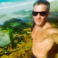   Hombre de 50 años Colon