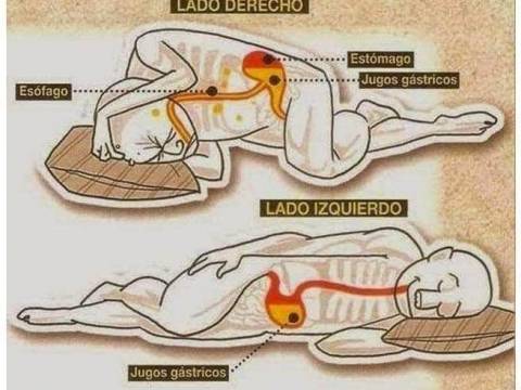 Lado Izquierdo del Cuerpo es Totalmente Diferente al Derecho