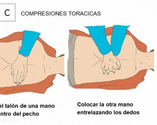 25320 3 Taller de Reanimación Cardio Pulmonar Básica (RCP) 